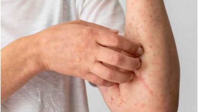 Photo of त्वचा से जुड़ी गंभीर बीमारी है एटोपिक डर्माटाईटिस,जानें क्या है इसके लक्षण
