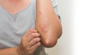 Photo of स्किन एलर्जी का कारण हो सकती हैं घर की ये चीजें…