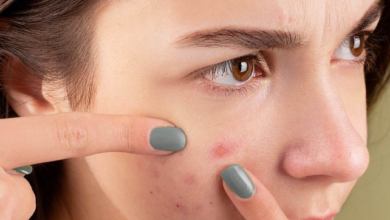 Photo of Skin Care Products For Acne: सालों से चेहरे के कील-मुंहासे ख़त्म होने का नहीं ले रहे नाम? अब दिखेगा गज़ब का कमाल