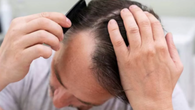Photo of Hair Loss In Men: ये हैं पुरुषों के बाल झड़ने के पीछे के 10 कारण!