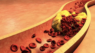 Photo of Cholesterol को खून से खींचकर बाहर निकाल देता है यह मसाला, जानिए कैसे करते हैं इसका सेवन