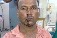 Photo of जातिसूचक टिप्पणी का विरोध करने पर मारपीट, चार पर मुकदमा दर्ज