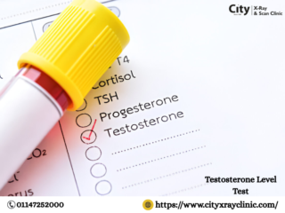 Testosterone-Level-Test